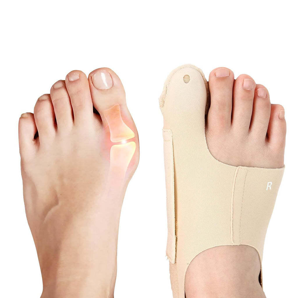 Bunion Corrector for Women & Men, Lightweight Toe Separator Splint, Wear in Shoes, Relieves Hallux Valgus Pain, Adjustable Toe Straightener Brace, Medium